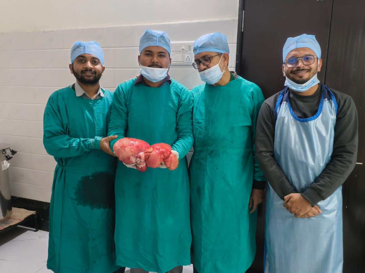 नांदेडच्या मरियम मल्टी स्पेशालिटी हॉस्पिटलमध्ये यशस्वी जटिल शस्त्रक्रिया करून महिलेच्या पोटातून 4.5 किलोचा ढेकूळ काढण्यात आला.